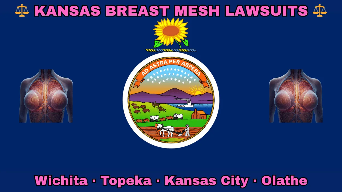 KANSAS BREAST MESH LAWSUITS: Wichita, Kansas City, Olathe, and Topeka text on KS state flag adorned with internal bra implants depicted on a blue background near the official seal and a sunflower emblem