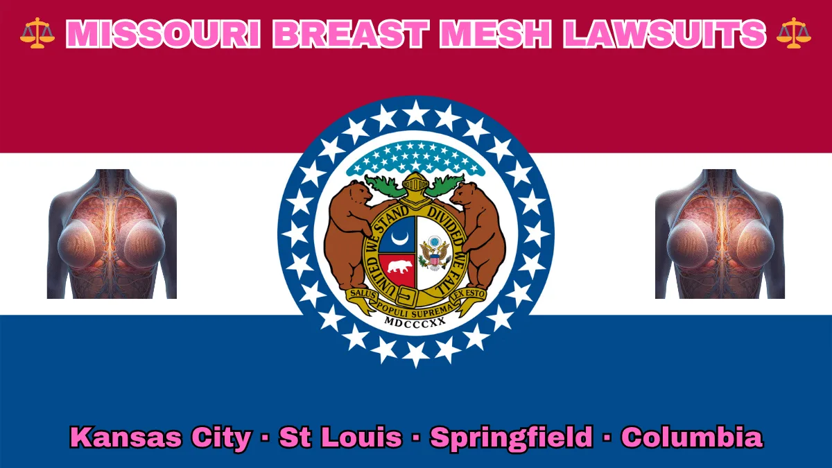 MISSOURI BREAST MESH LAWSUITS: Kansas City, St Louis, Springfield, and Columbia text on MO state flag adorned with internal bra implants depicted near a ring of stars featuring two grizzly bears, a shield, and crescent moon, all on a red, white and blue background.