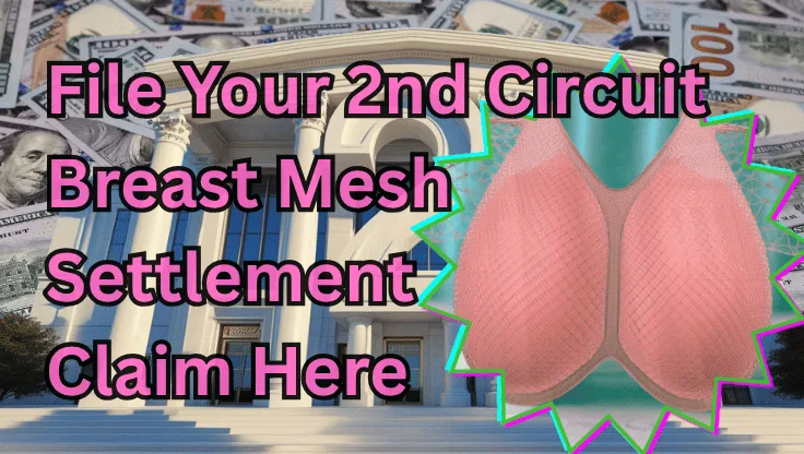 File Your 2nd Circuit Breast Mesh Settlement Claim Here text on depiction of Second Circuit court with an internal bra and high-value cash backdrop.
